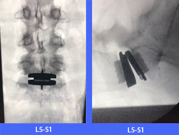 x-rays-before-after image