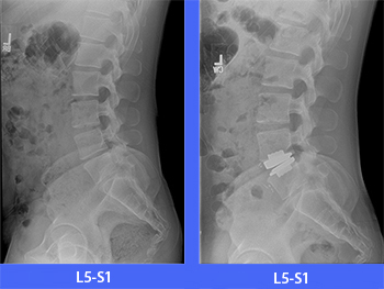 x-rays-before-after image
