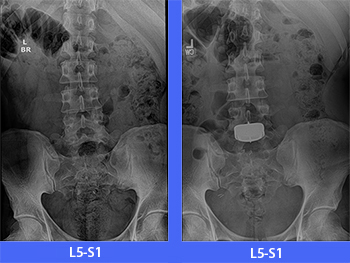x-rays-before-after image